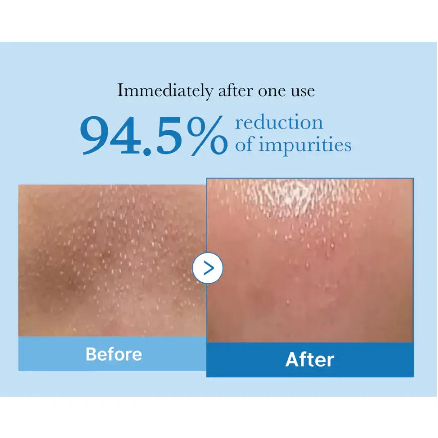 Medicube Zero Pore Blackhead Deep Cleansing Oil