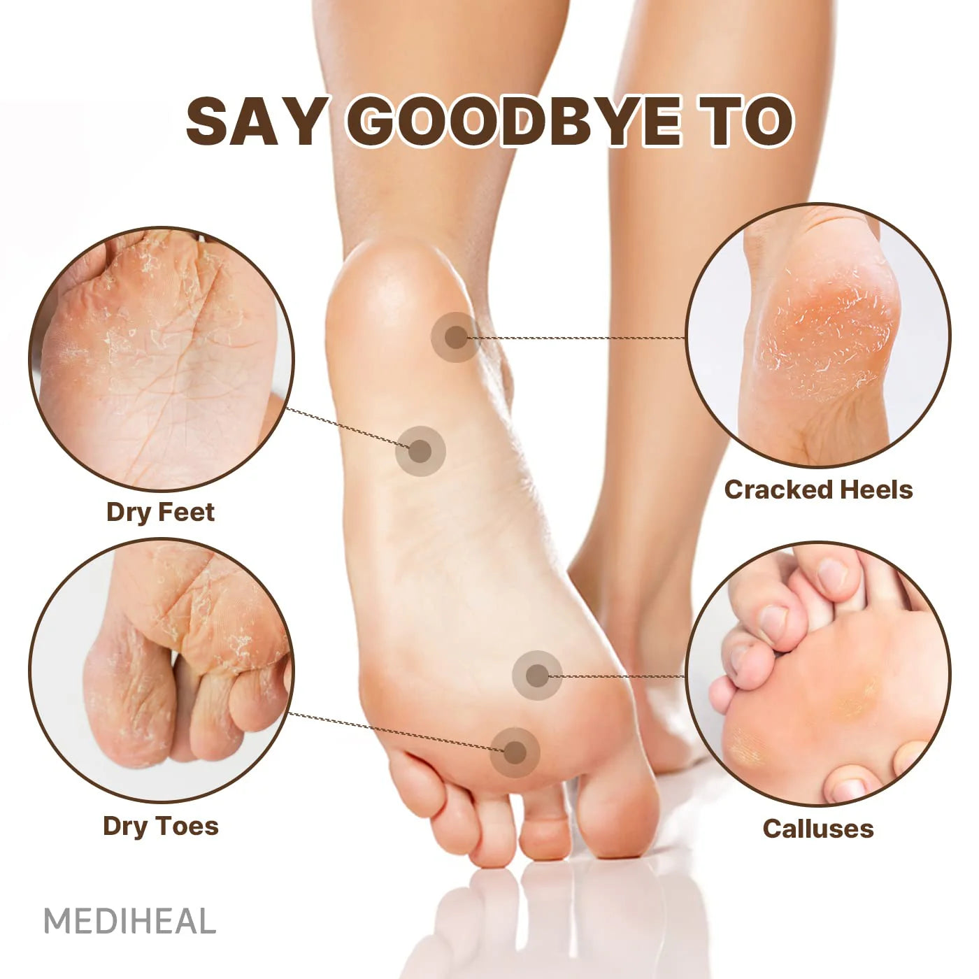 Mediheal Foot Mask 5pk